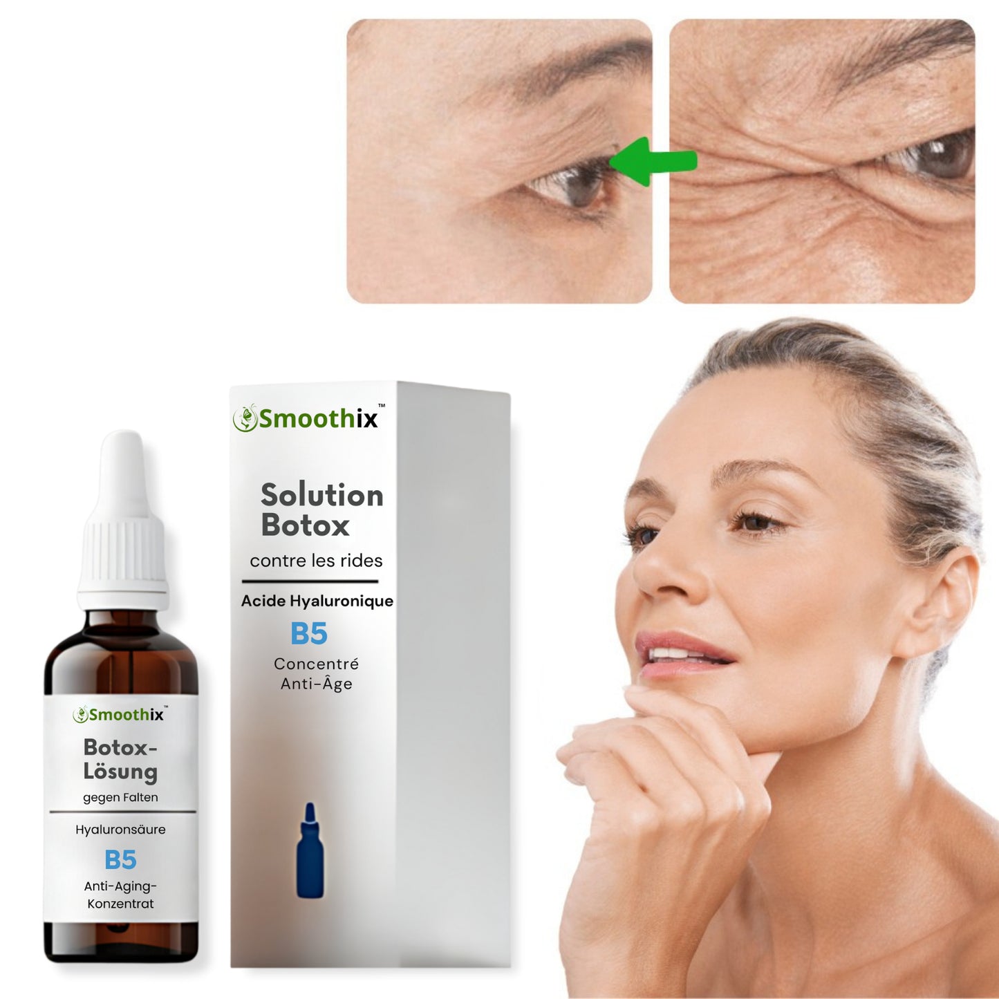 Smoothix™ Solution Botox | Réduit 98 % des rides et ridules en seulement 15 heures !