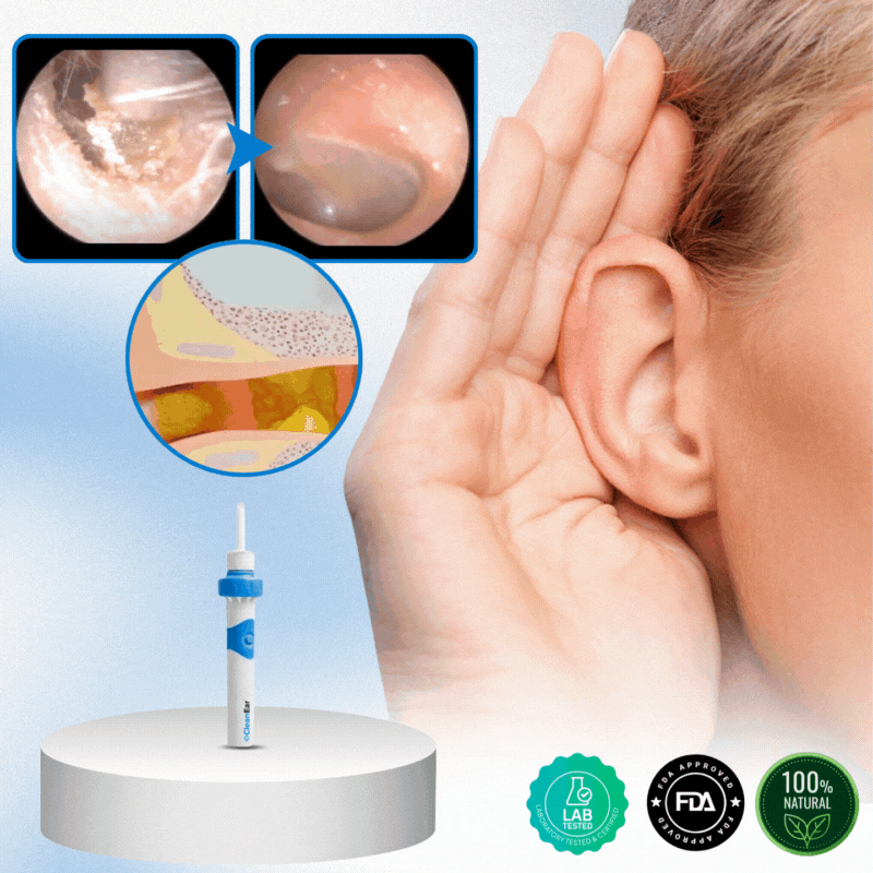 CleanEar™ | Éliminez jusqu’à 95 % du cérumen grâce à une aspiration douce et contrôlée en seulement 60 secondes !