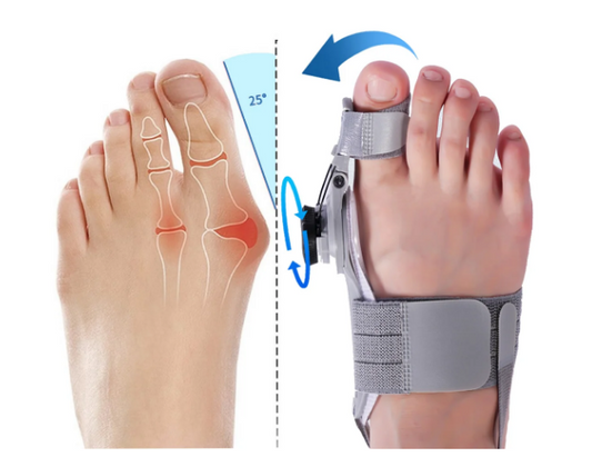 Glamova Bunion Fix (Copy)